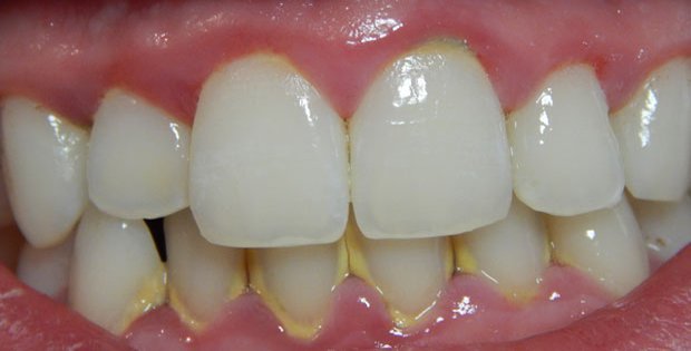 Sarro dental